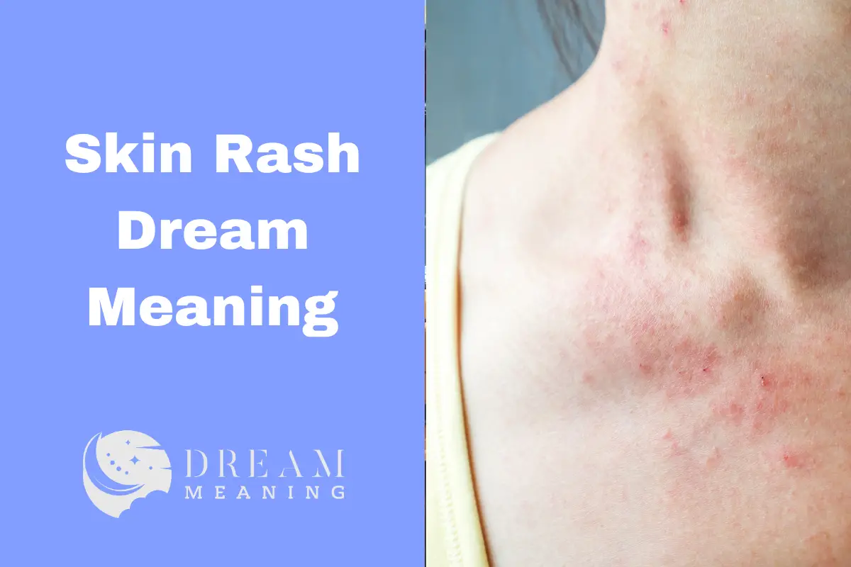 dream-interpretation-what-does-it-mean-when-you-have-skin-rash-in-your