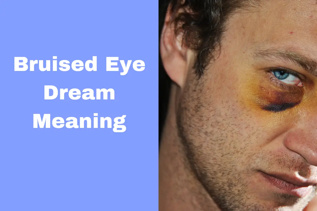 Bruised Eye Dream Meaning